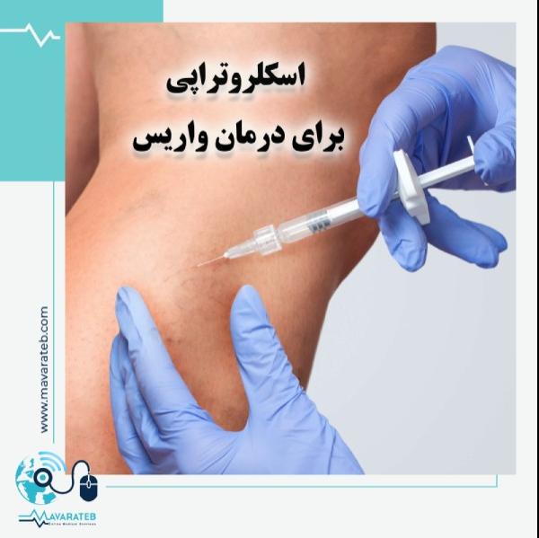 درمان واریس با اسکلروتراپی