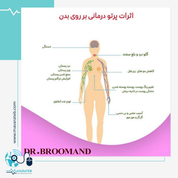 اثرات پرتو درمانی بر بدن