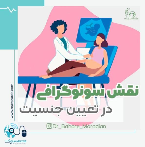 سونوگرافی؛ برای تعیین جنسیت جنین