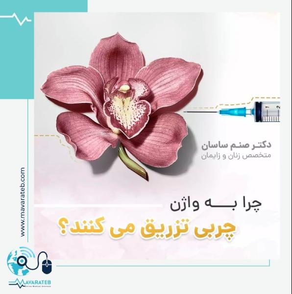 تزریق چربی به واژن برای جوانسازی