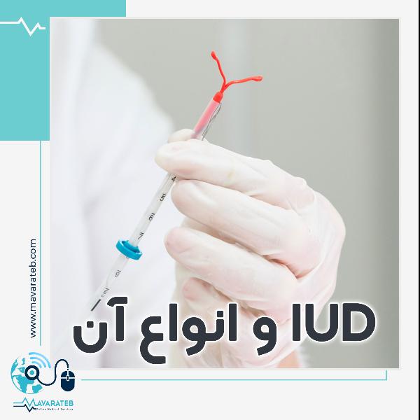 جلوگیری از بارداری به روشIUD