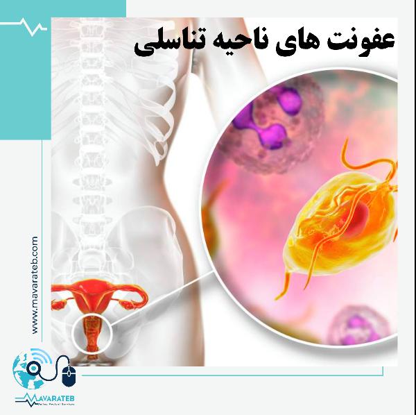 عفونت های ناحیه تناسلی