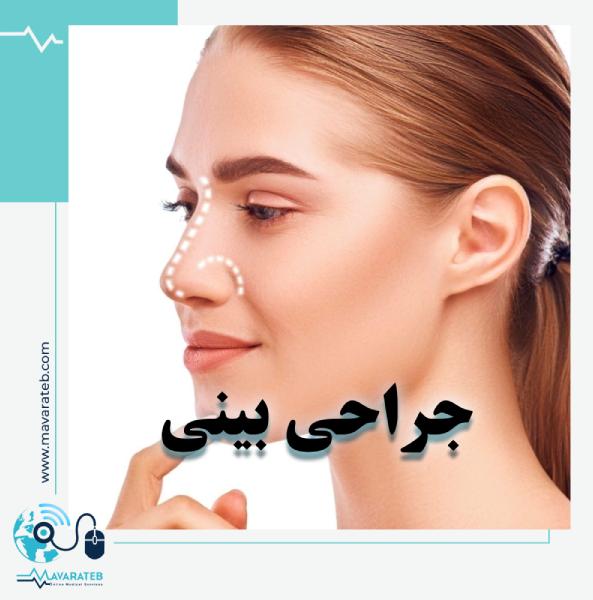 راهنمای جامع عمل جراحی بینی