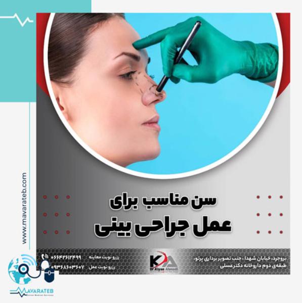 سن مناسب برای عمل جراحی بینی