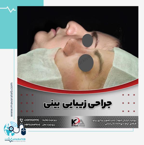 جراحی زیبایی بینی