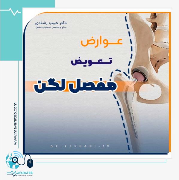 تعویض مفصل لگن