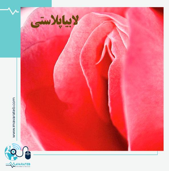لابیاپلاستی