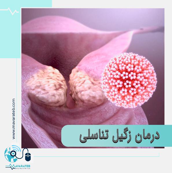 جدید ترین روش درمان زگیل تناسلی