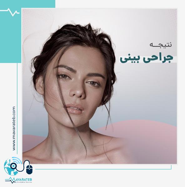 نتیجه جراحی بینی