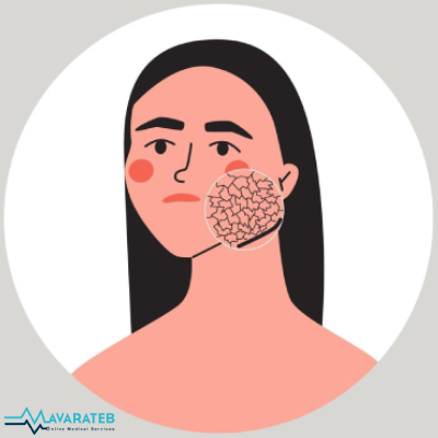 علت و درمان خشکی پوست در زمستان