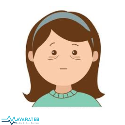 علت تیرگی زیر چشم و روش‌های قطعی از بین بردن آن